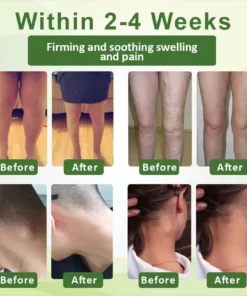 Fivfivgo™ SwellSoothe Lymphatic Cream