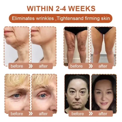 Flysmus™ BotoxBee Wrinkle Removal Cream - Image 2